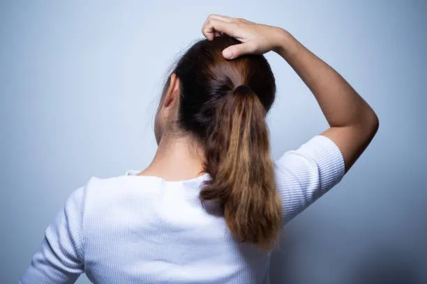 How to Get Rid of Lice in Adults’ Hair?