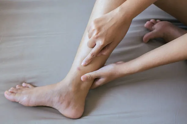 Why Do Fleas Bite Ankles?