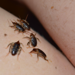 Chiggers on Skin!